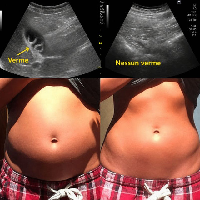 Aceite de ricino orgánico: reduce la hinchazón abdominal mientras duermes.