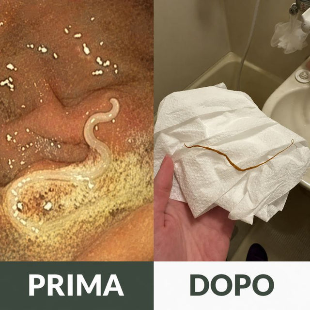 Aceite de ricino orgánico: reduce la hinchazón abdominal mientras duermes.